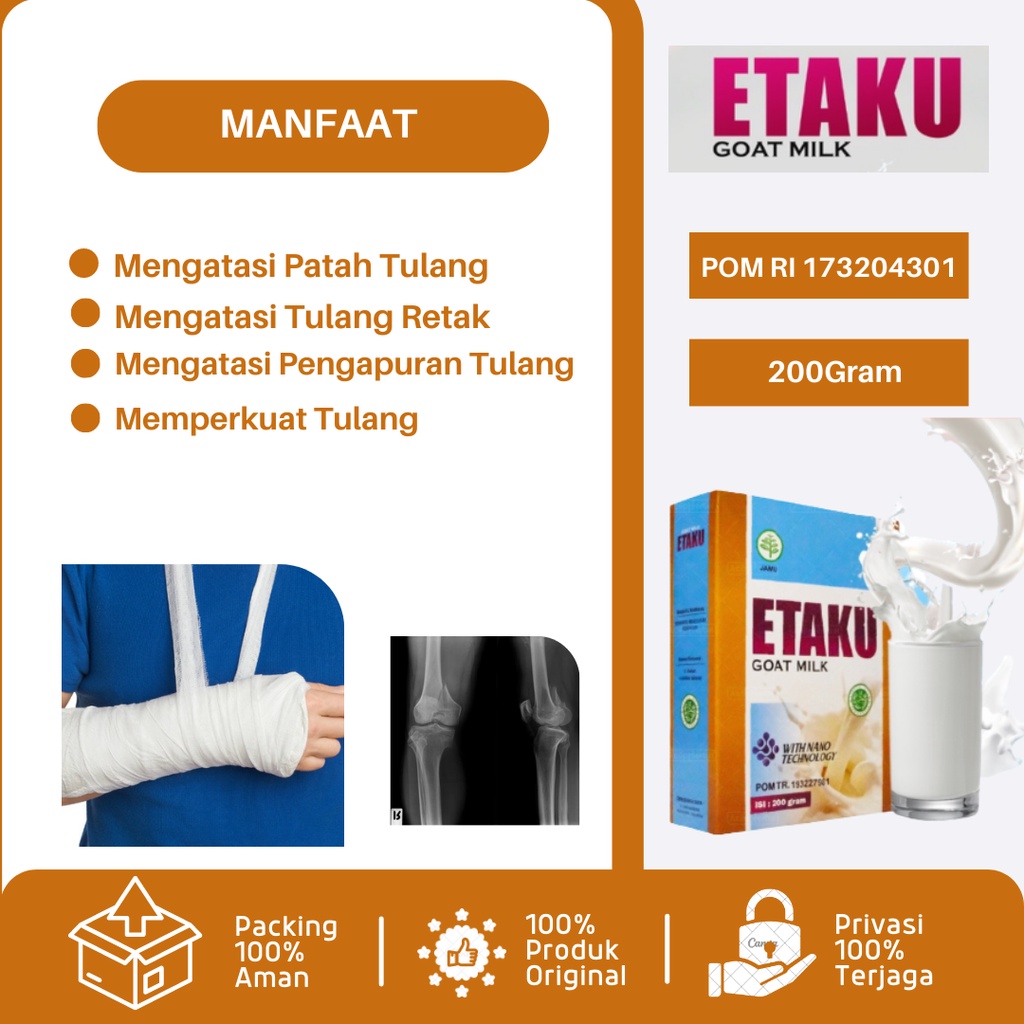 Susu Untuk Patah Tulang, Susu Patah Tulang Dan Retak, Susu Untuk Patah Tulang Pada Anak, Susu Tulang