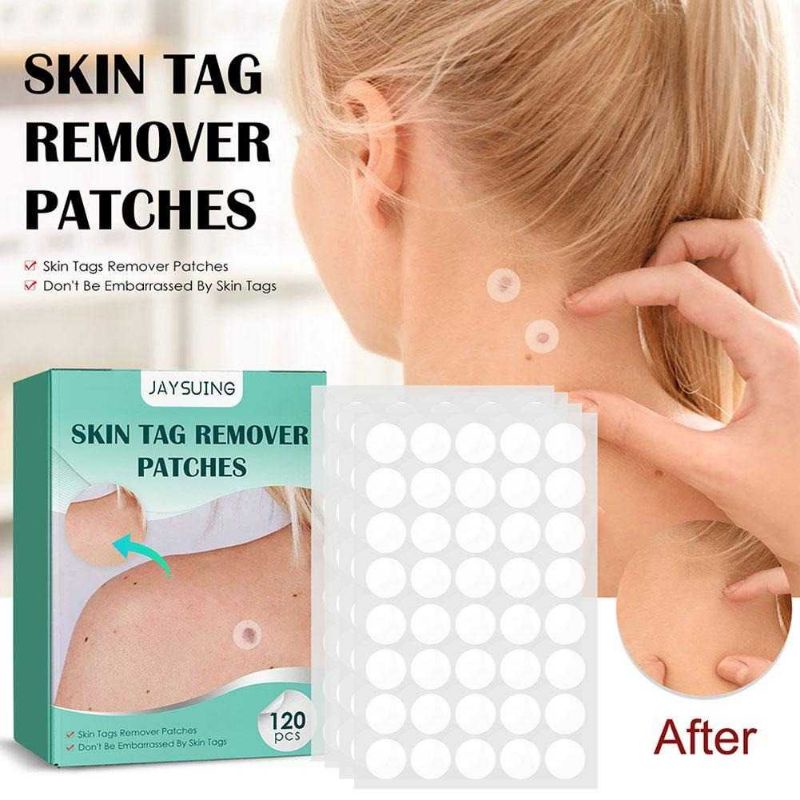 JAYSUING Stiker Penghilang Kutil Tahi Lalat Wart Removal Patch 120 PCS - JY12