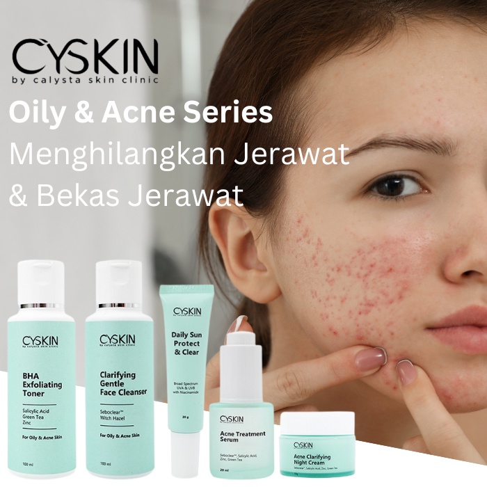 Paket Acne Cyskin Skin Care Muka Berjerawat Flek Hitam For Oily Skin