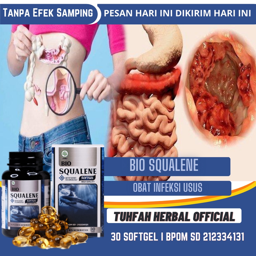 Obat Infeksi Usus, Obat Usus Buntu, Obat Radang Usus Besar, Obat Kram Usus, Usus Buntu Bocor, Obat U