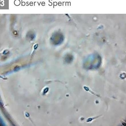 

Loupe Smartphone Sperm Observation Kit