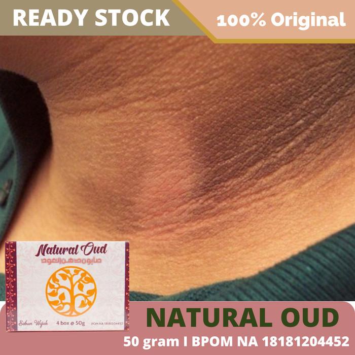 Sabun Penghilang Hitam Di Belakang Leher, Obat Pemutih Leher Hitam