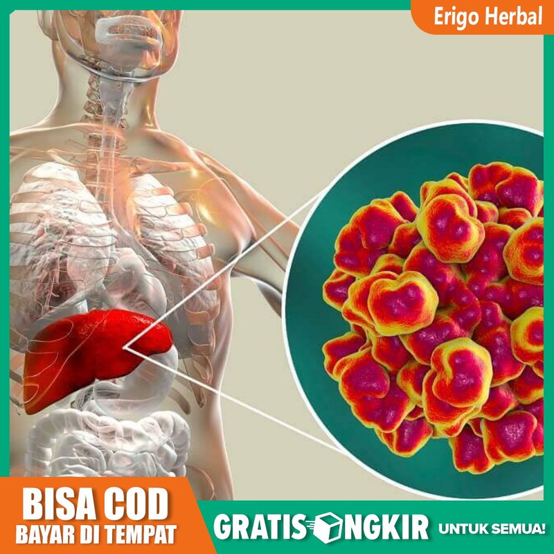 

OBAT HERBAL HEPATITIS B Penyakit Kuning ALAMI QNC JELLY GAMAT ORIGINAL Di Tangerang