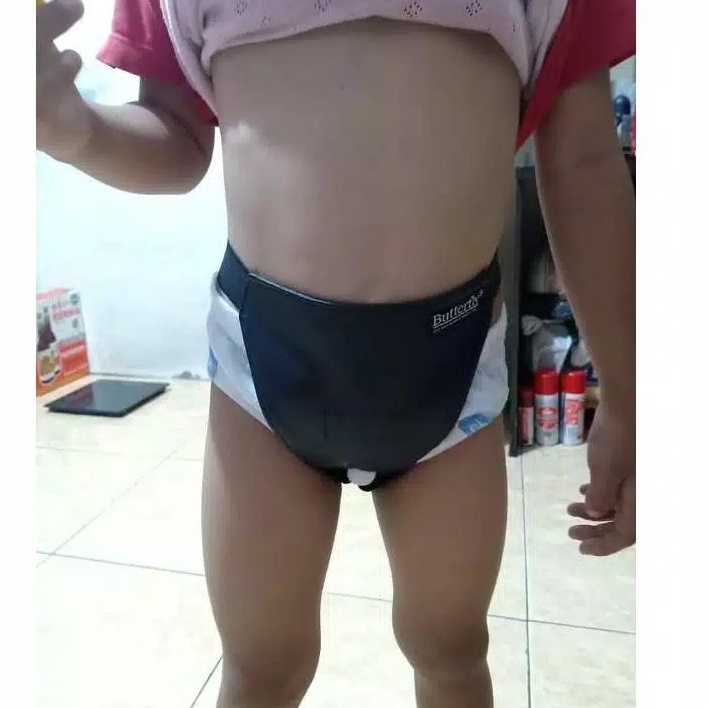 GVYV9851 Terlaku.../ Celana Hernia Anak Balita Bayi Laki Perempuan