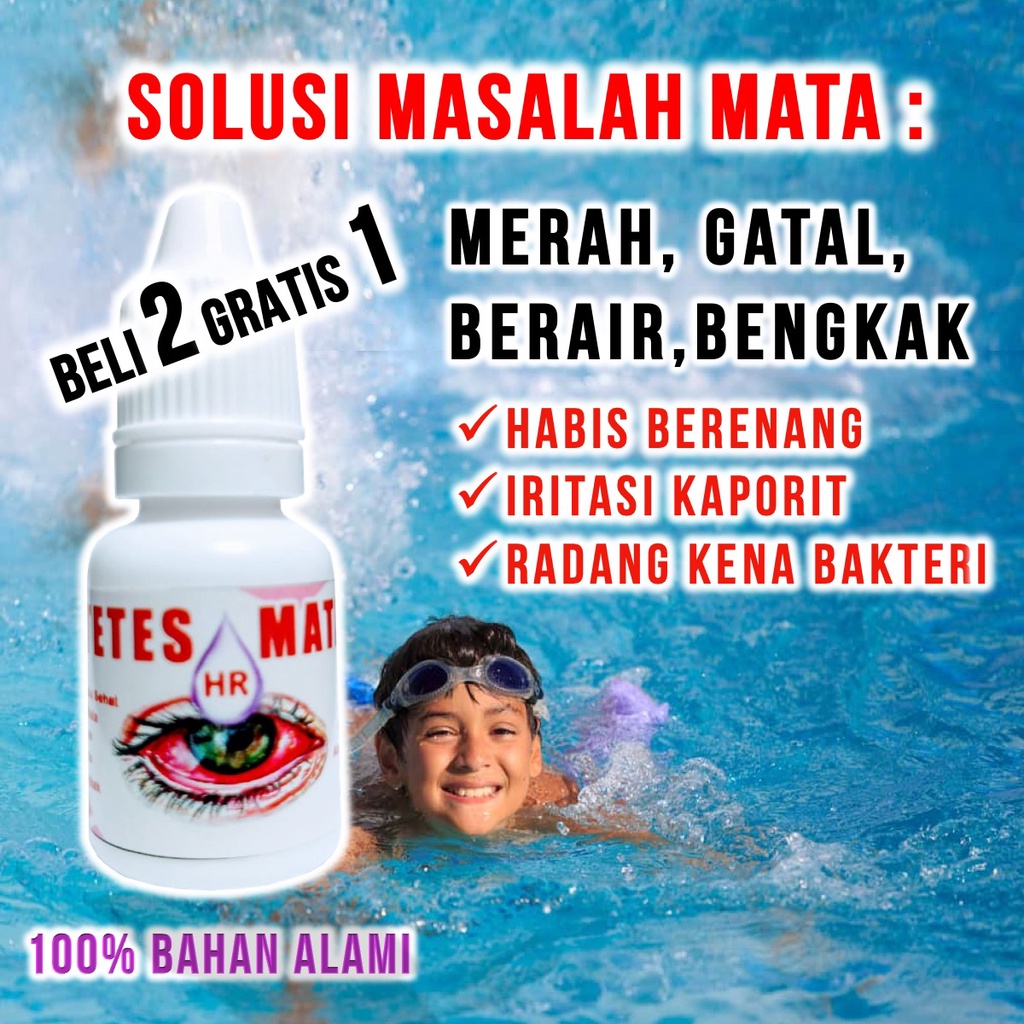 HR Tetes Mata Merah Iritasi Radang Perih Bengkak Gatal dan Berair