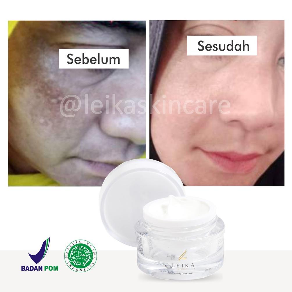COD TER ORIGINAL Krim Flek Hitam Melasma Membandel Tahunan Permanen BPOM Cream Menghilangkan Flek Hi