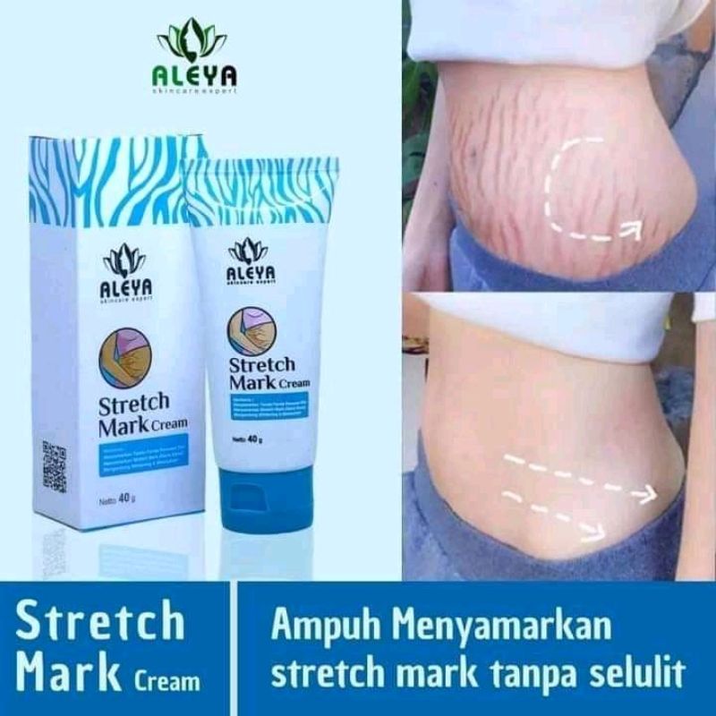 stretchmark cream aleya aman bumil busui BPOM