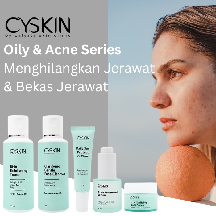 Skincare Atasi Jerawat Radang Calysta Skin Clinic
