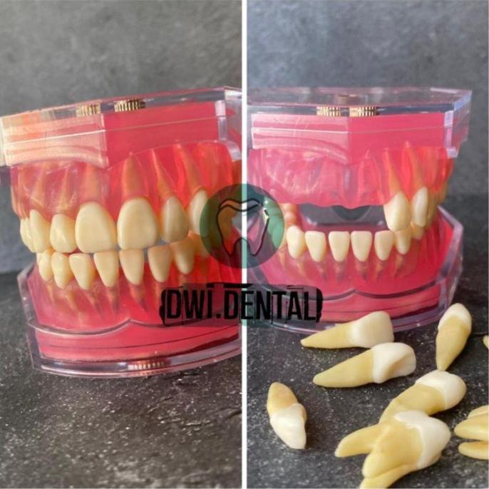 Unik Dental phantom model gigi study bisa di lepas pasang Diskon