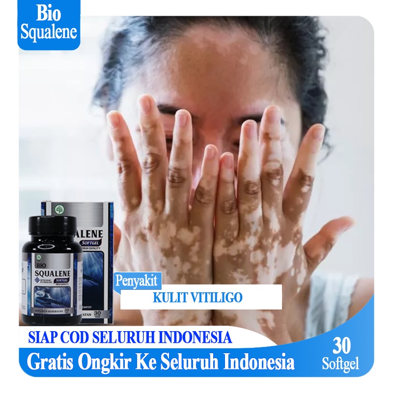 Vitiligo Bio Squalene Vitiligo Salep Vitiligo Obat Vitiligo