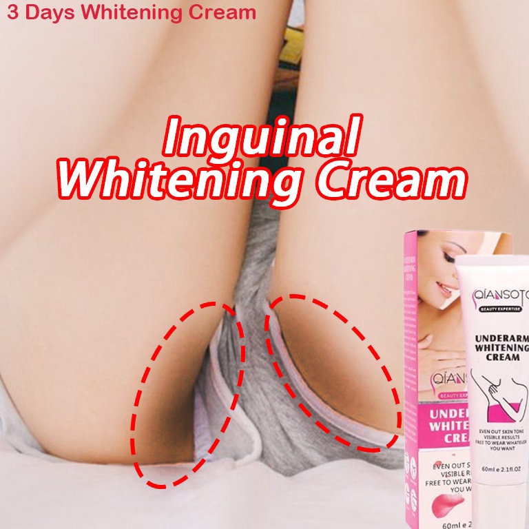ZG8133 Cream Krim Pemutih selangkangan Pemutih ketiak Underarm Whitening cream Perawatan kewanitaan 