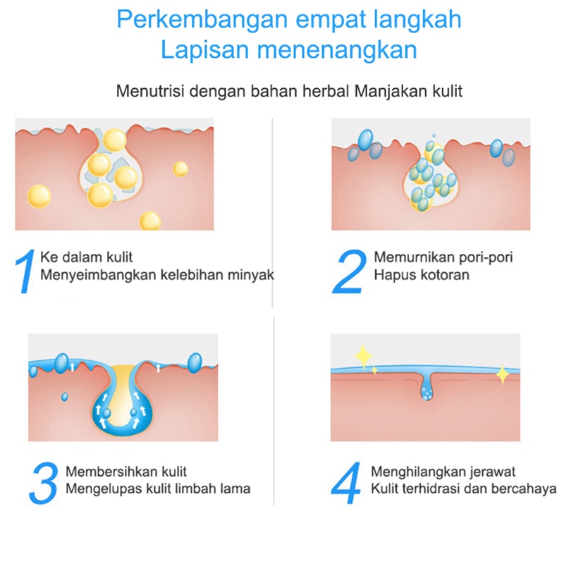 Serum Acne Obat Jerawat Obat Totol Jerawat 30g Herbal Obat Jerawat Dan Bekas Jerawat Obat Jerawat Dan Bekas Jerawat Paling Ampuh