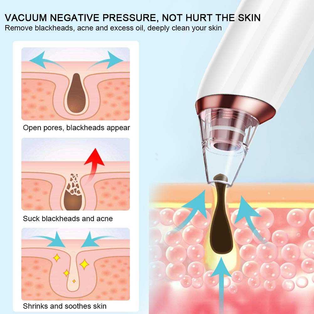 Hailicare Vacuum Suction Skin Face Care Blackhead Pore Cleaner KNY-E27 Pemutih Kulit Bayi Pemutih Kulit Bayi Alat Facial Hf Alat Facial Hf Hf Facial Hf Facial Alat Facial Komedo Alat Facial Komedo Kapsul Pemutih Kulit Kapsul Pemutih Kulit Celana Kulit Pri