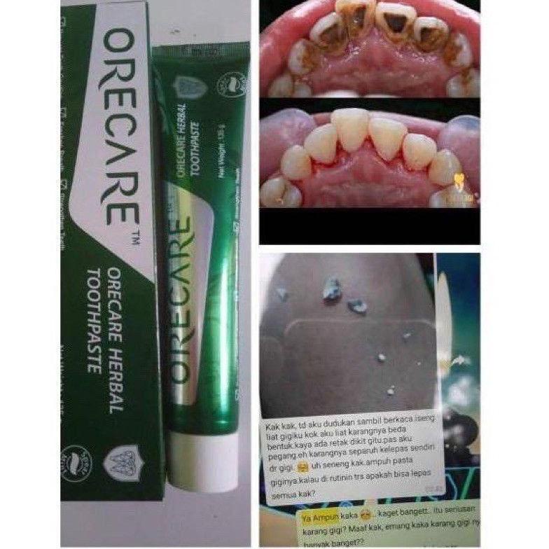 Kekinian PEMUTIH GIGI DAN PENGHILANG KARANG GIGI AMPUH | PEMUTIH GIGI HERBAL | PENUMBUH GIGI PENGHIL