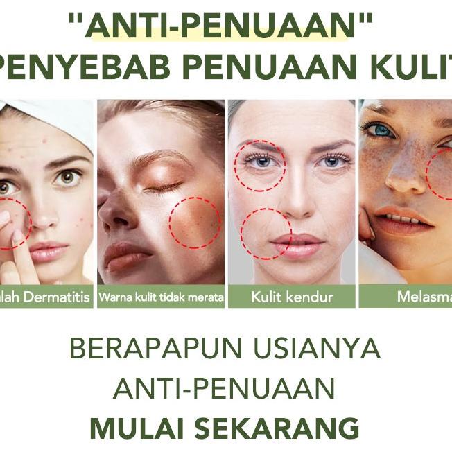 Ellen Ella Triple Retinol Cream + Serum + Lotion + Masker Wajah Combo Membuat Kulit Elastis, Lembut 