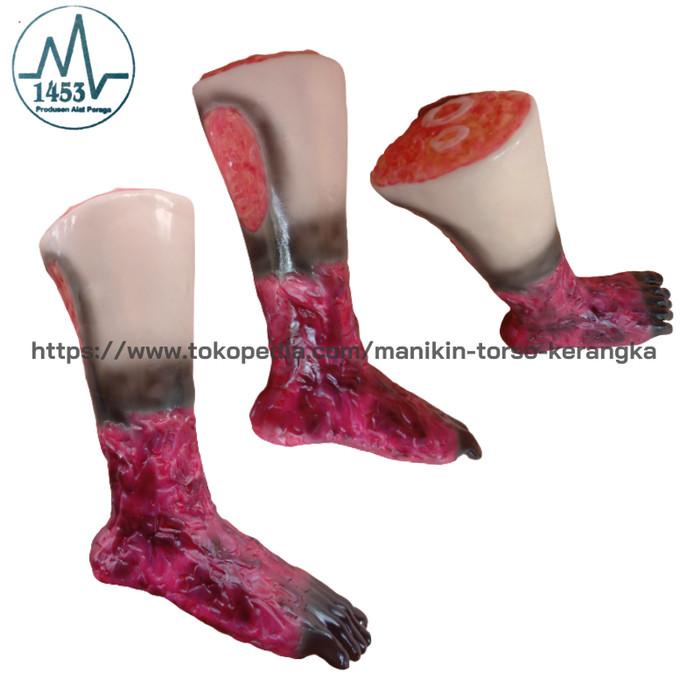 Terlaris Phantom Manikin Model Kaki Luka Bakar Bahan Silicone