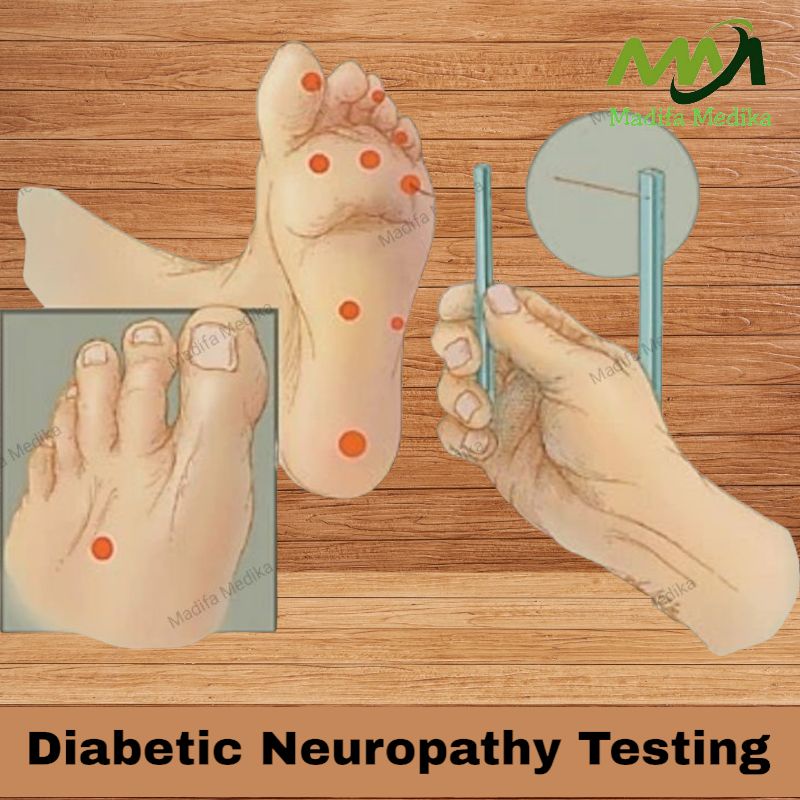 Diabetic  Neurophaty Testing  Alat Test Kaki Diabetes