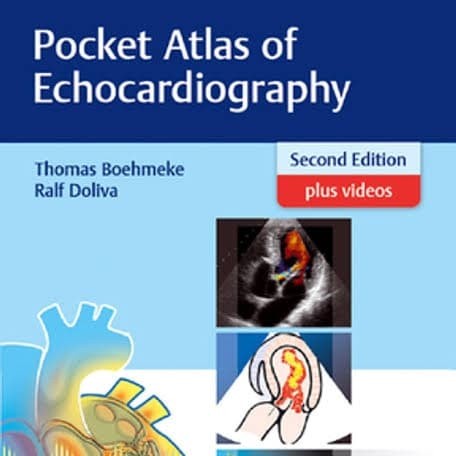 Terlaris Pocket Atlas Of Echocardiography