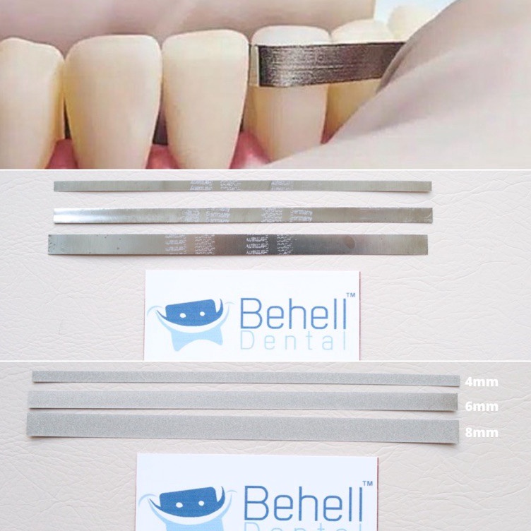 Bayar Di Tempat✾ ZP6SI Kikir Gigi Dental Abrasive Strip Steelcarbo strip Horico . Polishing Finishin