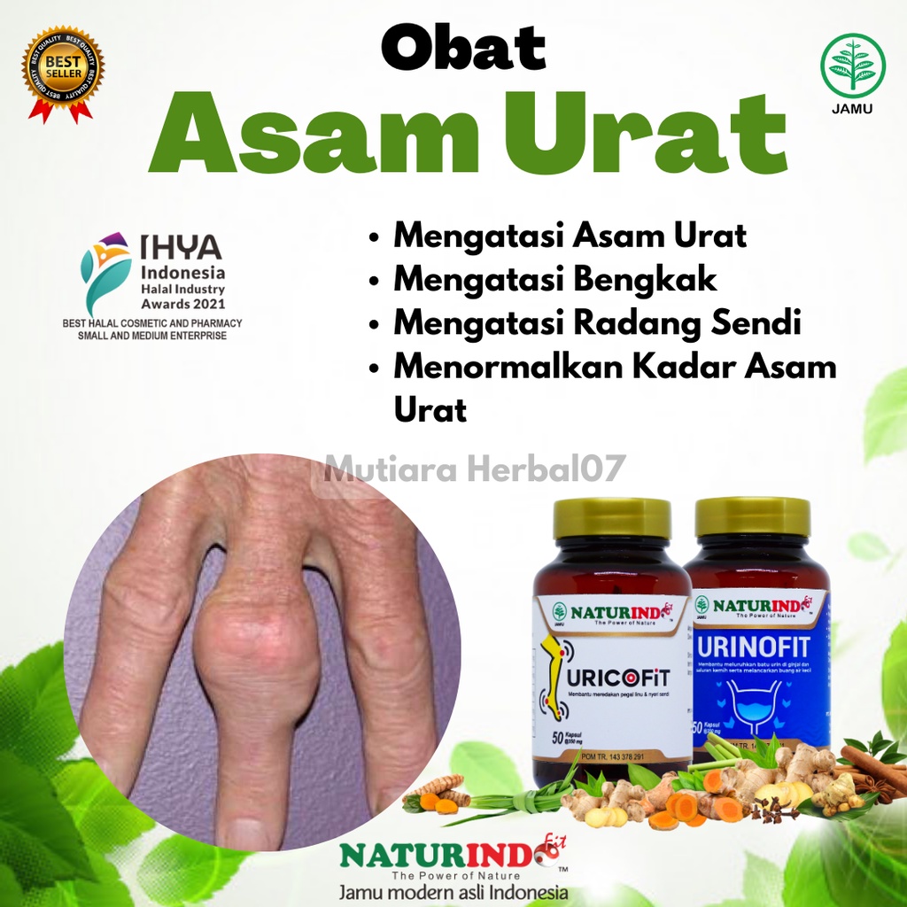 

Obat Asam Urat Paling Ampuh Nyeri Sendi Tulang Bengkak Herbal Naturindofit Uricofit