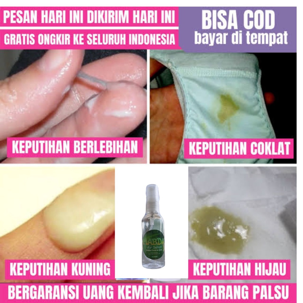 (CEPAT) Obat Keputihan, Mis V Ada cairan putih berwarna susu, cairan kehijauan, cairan keabuan Herba