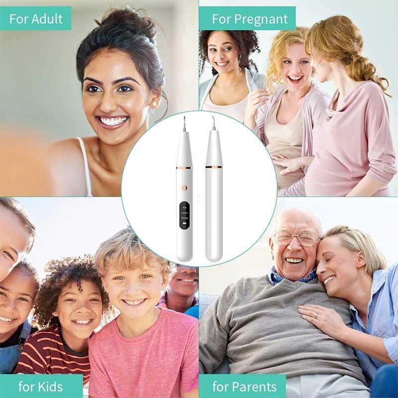 YUKUI Pembersih Karang Plak Gigi Ultrasonic Dental Calculus Electric S5