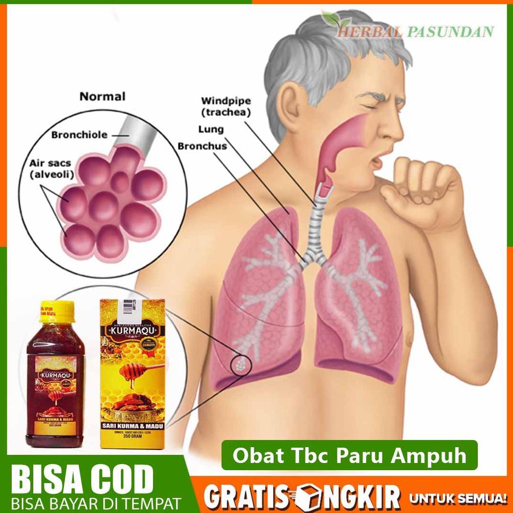 

Bayar Ditempat - obat herbal tbc paru paru kronis, berkeringat dingin, lemas 100% original qurmaku sari kurma