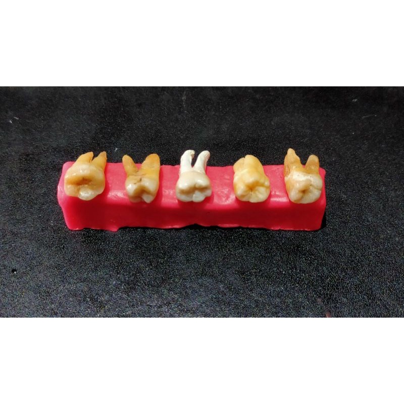 Gigi Asli Praktikum Molar