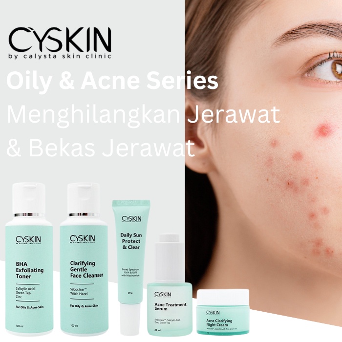 Gabung Reseler Cyskin Calysta Acne Care Semarang