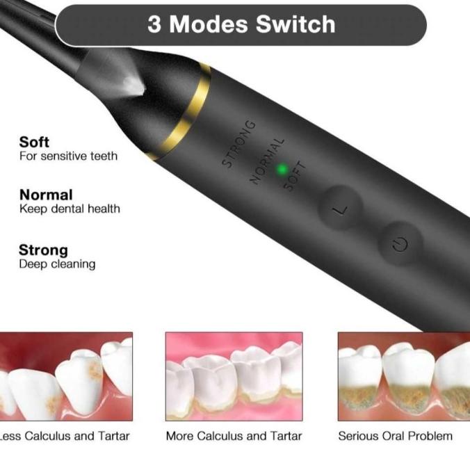 Alat Pembersih Karang Gigi Ultrasonic Smart Ultrasonic Dental Scaler [Cod]