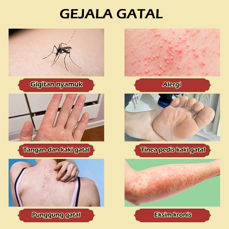 【100% ASLI】[BPOM]&amp;[COD]krim obat herbal alami mengatasi gatal, salep anti pruritus, salep eksim, salep kulit, salep antinprirutus paling efektif, salep psoriasis, psoriasis kulit kepala, kurap tangan, kulit infeksi jamur