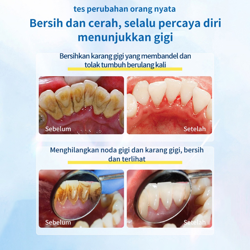 paling ampuh pemutih gigi dan penghilang karang gigi 100g probiotik Pemutih Gigi Pasta perontok karang gigi Gigi Untuk Menghilangkan Bau Mulut Pasta Gigi Herbal Untuk Memutihkan Gigi Untuk Menghilangkan Untuk Menghilangkan Bau Pemutih gigi kuning Pasta