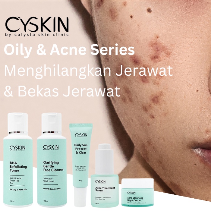 Join Reseller Cyskin Skincare Paket Jerawat Solo
