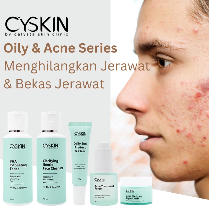 Paket Join Cyskin Calysta Paket Acne Semarang