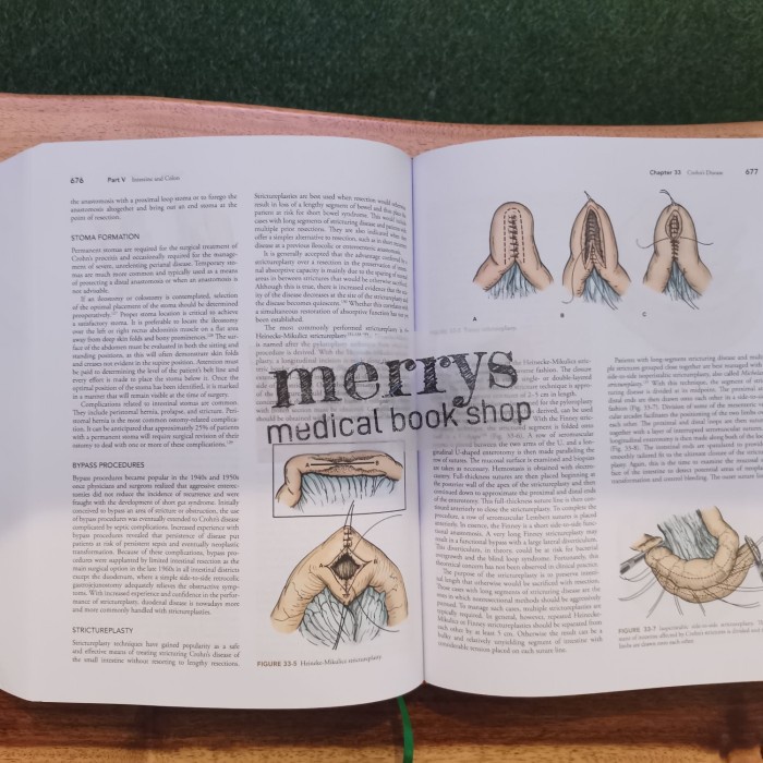 Diskon Spesial Maingots Abdominal Operations, 12Th Edition Termurah