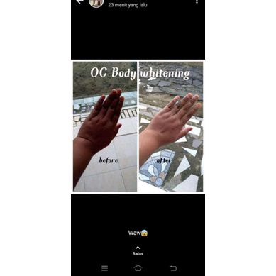 oc body whitening / Hb pemutih dosis teriple