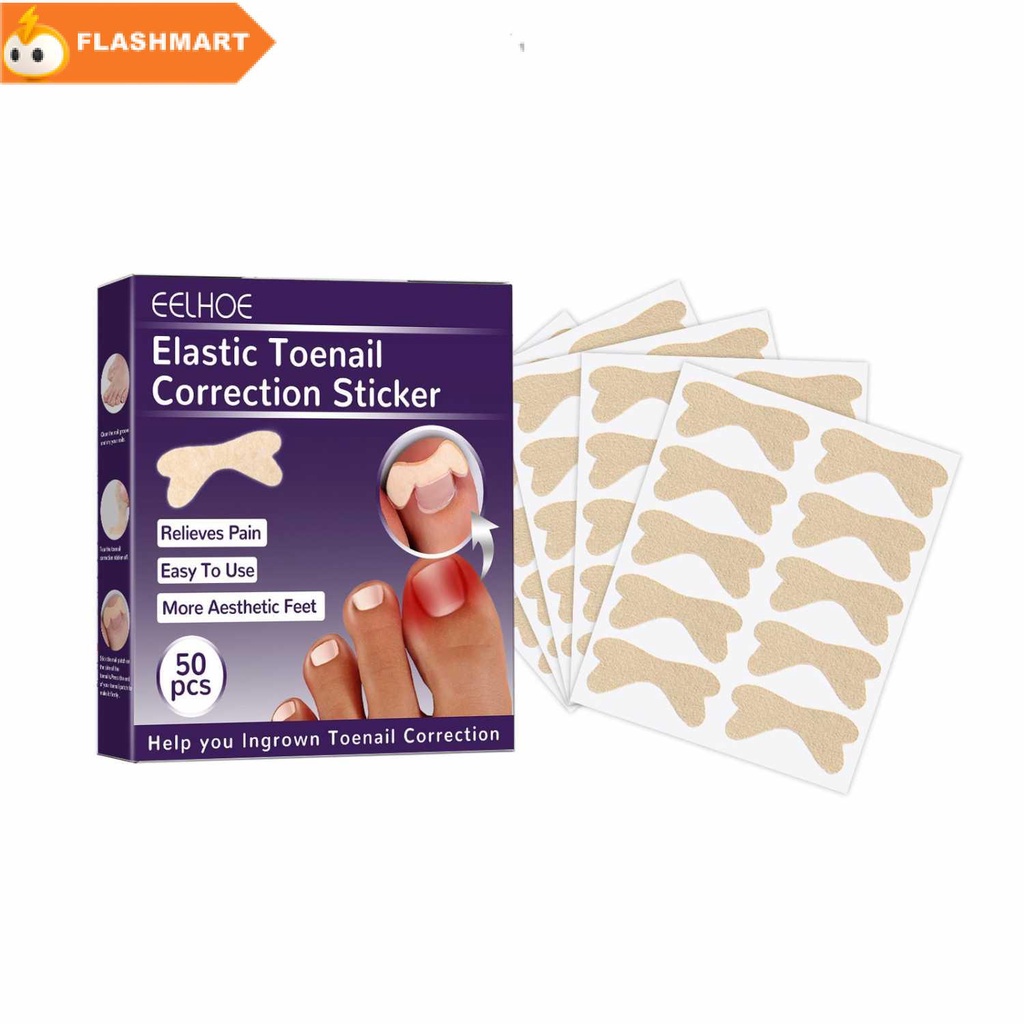 FLASHMART Stiker Korektor Kuku Kaki Adhesive Ingrown Toenail Patch 50 PCS - EH-50