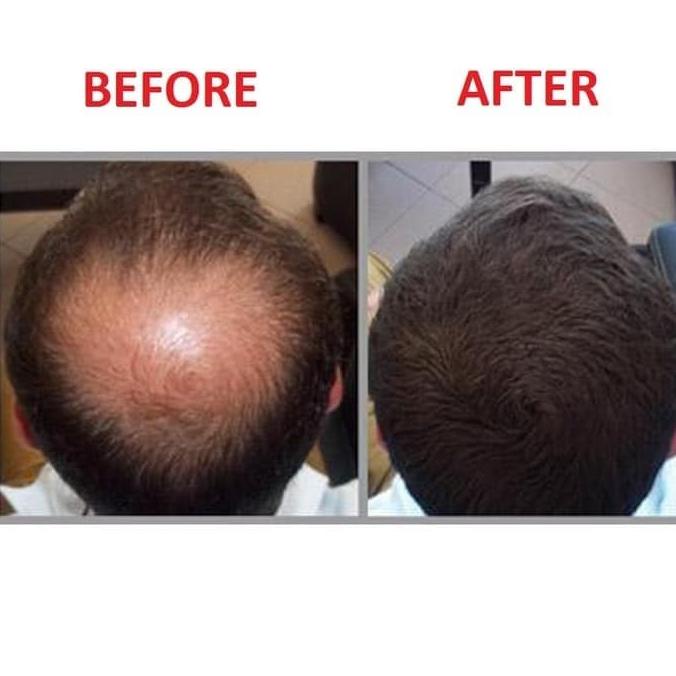 CABOKI Hair Fiber 25g ORIGINAL 100%