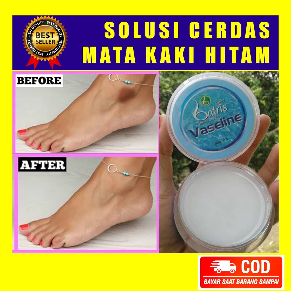 UNS SALEP OBAT MATA KAKI HITAM KAPALAN KERING AMPUH TANPA EFEK SAMPING PANAS PERIH IRITASI WXL