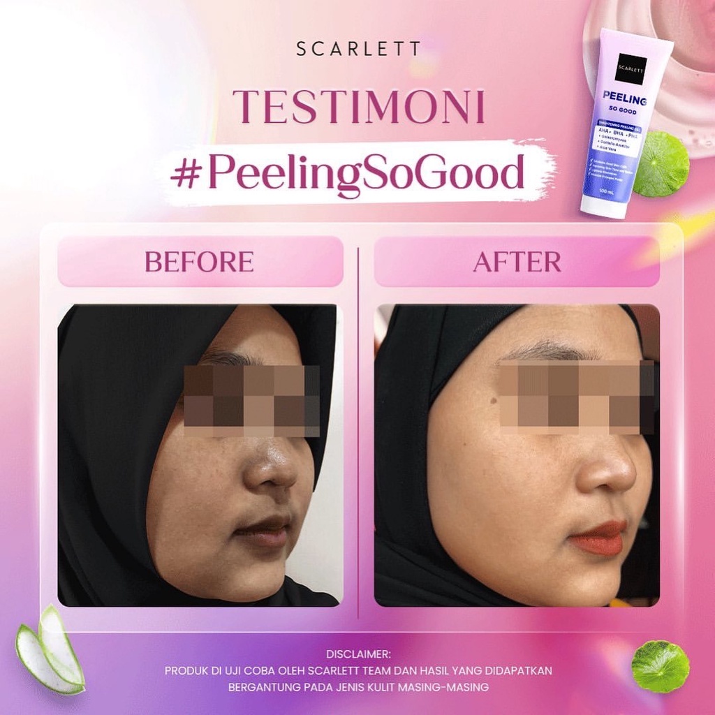 SCARLETT WHITENING Peeling So Good / Brightening Peeling Gel 100ml