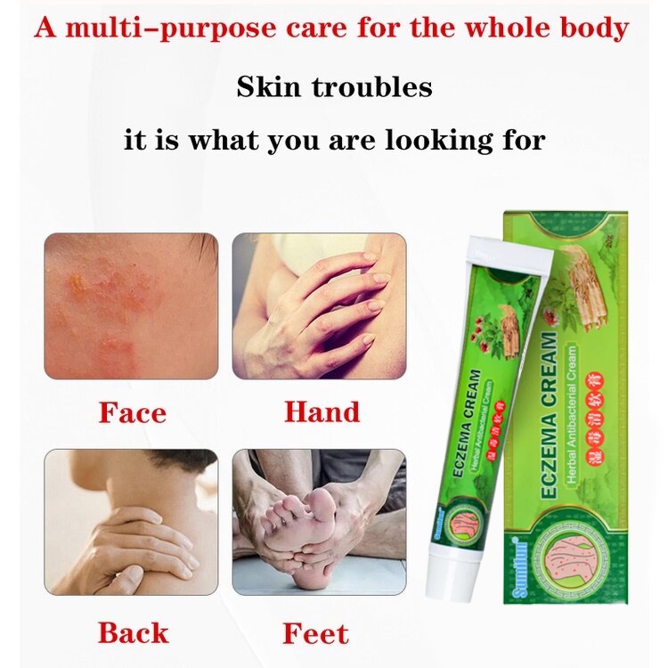 Salep gatal Salep Eksim Salep kulit Krim psoriasis paling ampuh Kulit Kepala Psoriasis Tangan Tinea Kaki Bau Versicolor Menghambat Dermatitis Jamur Anti Gatal Cream 20g