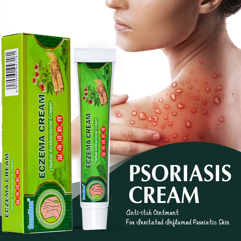 Salep gatal Salep Eksim Salep kulit Krim psoriasis paling ampuh Kulit Kepala Psoriasis Tangan Tinea Kaki Bau Versicolor Menghambat Dermatitis Jamur Anti Gatal Cream 20g