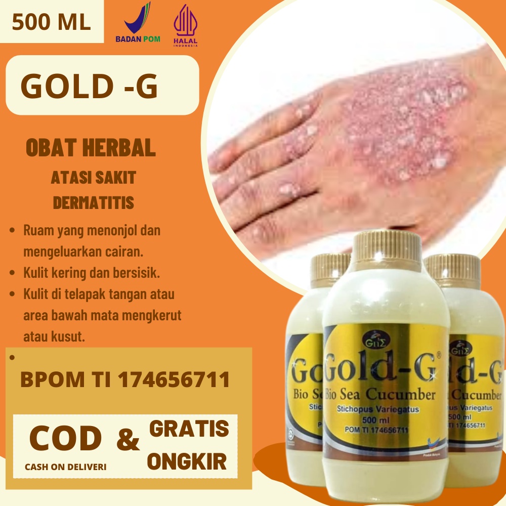 Obat Herbal Dermatitis Menahun Obat Penyakit Kulit Dermatitis Kontak Kulit Gatal Ruam Kemerahan Infe