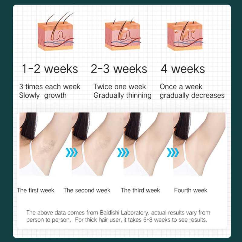 Lescolton IPL Laser Epilator Permanent Hair Removal 990000 Flashes T010 Alat Pencukur Bulu Kemaluan Alat Pencukur Bulu Kemaluan Obat Perontok Bulu Kemaluan Obat Perontok Bulu Kemaluan Pencukur Bulu Kemaluan Pria Pencukur Bulu Kemaluan Pria Waxing Bulu Waj