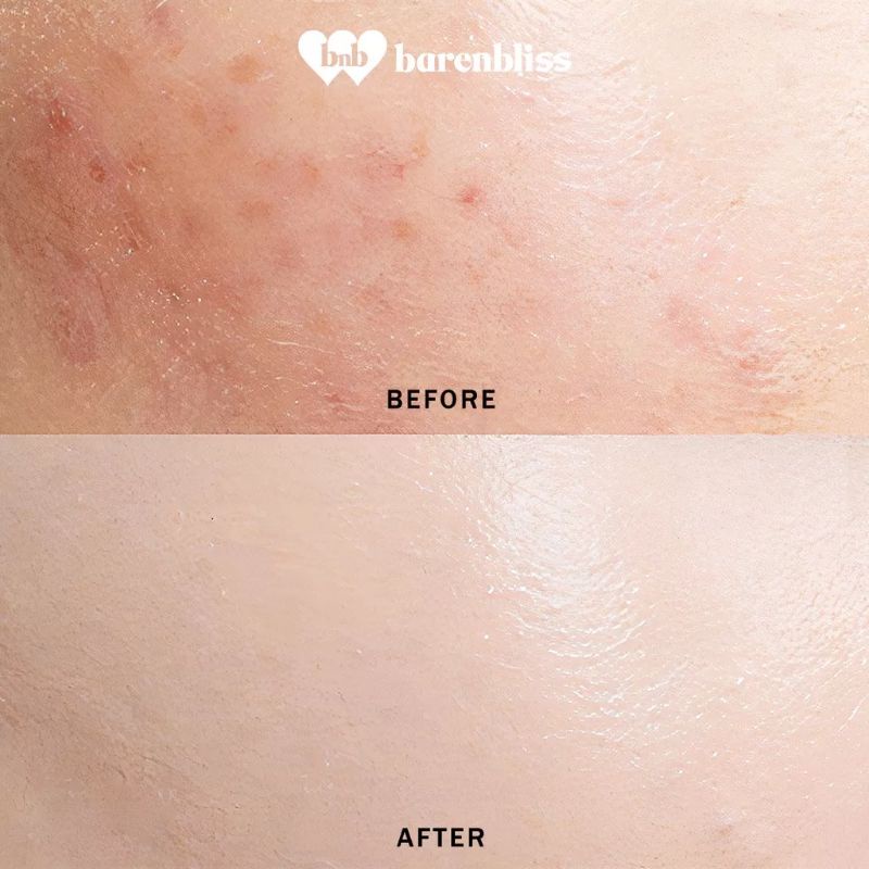 BNB barenbliss Korean Bloomatte Start-Over Concealer「Full Converage | Tahan Lama 24 Jam」