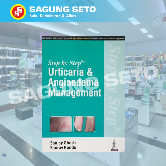 Diskon Spesial Step By Step Urticaria & Angioedema Management - Ghosh / Dermatology Termurah