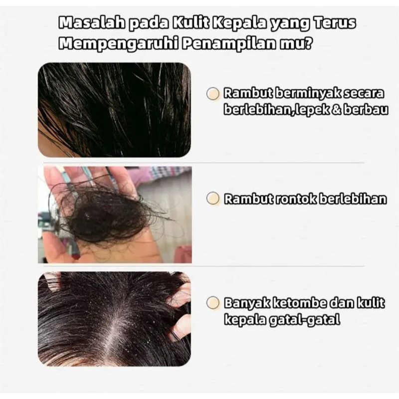 {FREE BONUS HEBOH ALAT PIJAT WAJAH}Remimpi Anti Hair Fall Hair Treatment Shampoo Oil Control  Anti -dandruff Anti Hair Loss Anti Rambut rontok