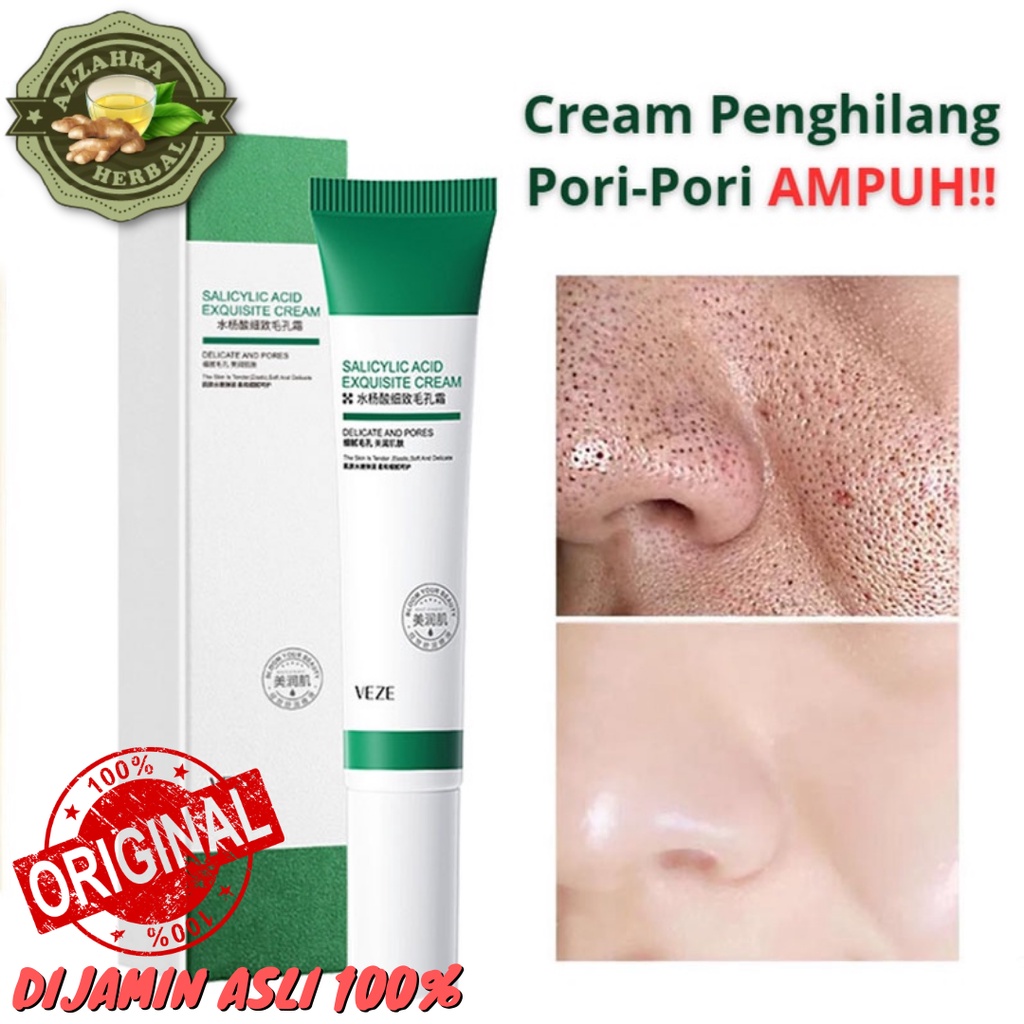 [20ML] Salicycid Acid Krim Penghilang Pori-Pori Komedo Tersumbat Jerawat Removal Eksfoliasi VENZEN Asam Salisilat