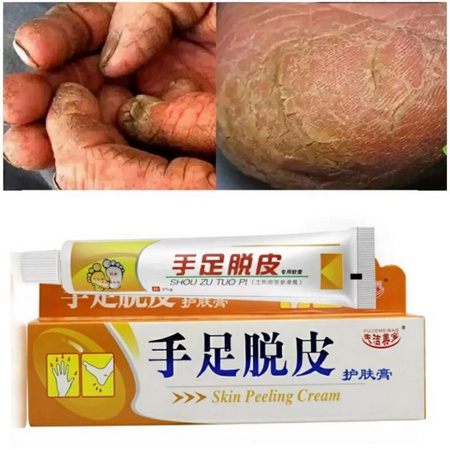 SALEP TUMIT KAKI PECAH-PECAH TANGAN KAPALAN ( SKIN PEELING CREAM )