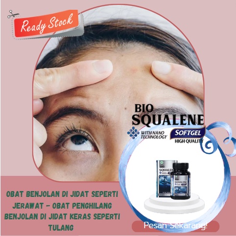 Obat benjolan di jidat seperti jerawat,  penghilang benjolan di jidat keras seperti tulang - Bio Squ